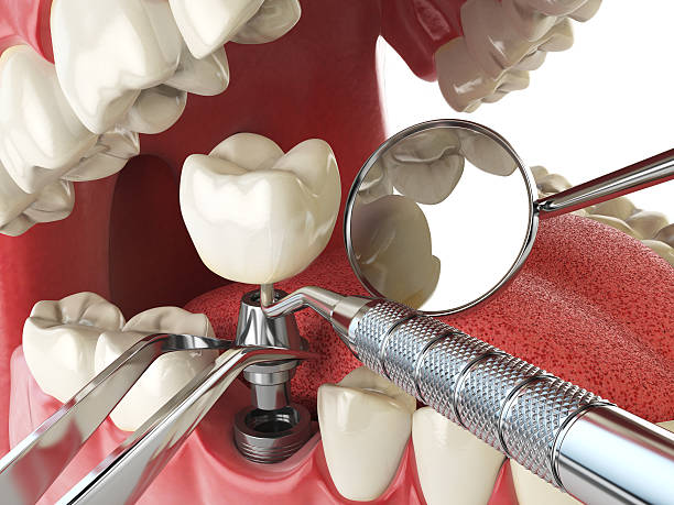 Best Emergency Dental Care for Broken or Chipped Teeth in Nanakuli, HI