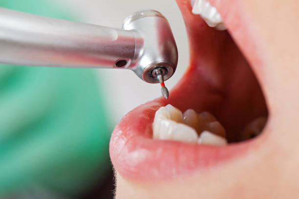 Best Emergency Treatment for Dental Infections or Abscesses in Nanakuli, HI